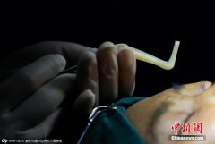 中国跻身全球第三大医疗美容市场 投诉3年上升