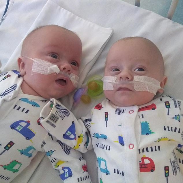 英国最小双胞胎乔·基茨和阿什力·基茨。（每日邮报）