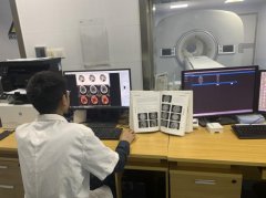 我自主研发的全球首台脑数字PET取得重要进展