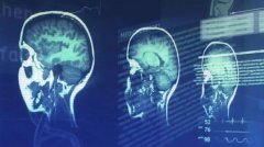 英特尔AI医疗实战曝光：10倍加速辅助诊断、准确