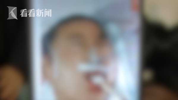 视频｜男孩发烧险成