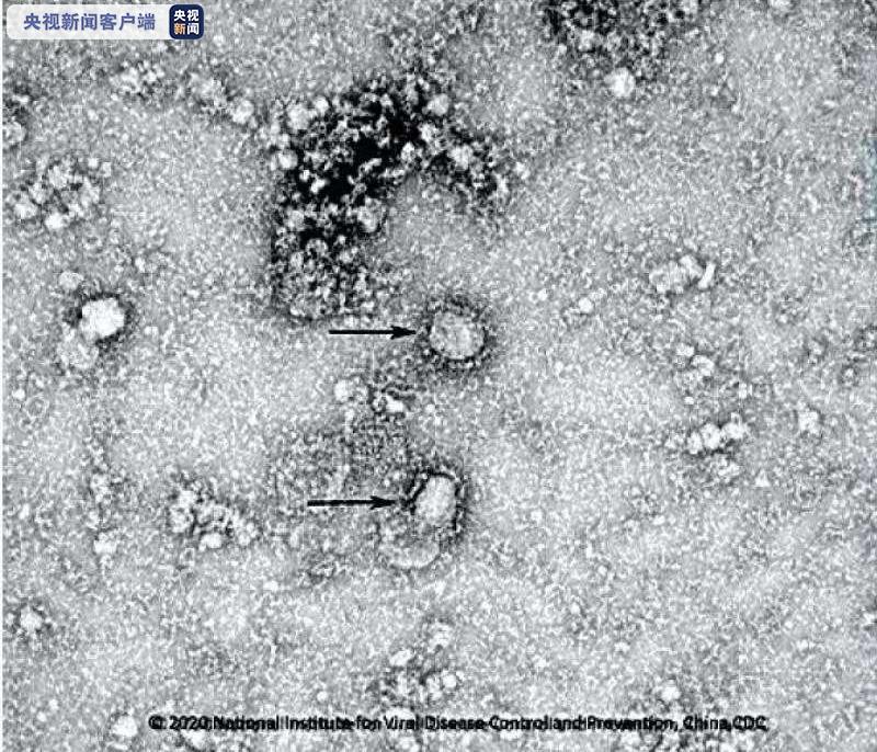 新型冠状病毒国家科技资源服务系统正式启动