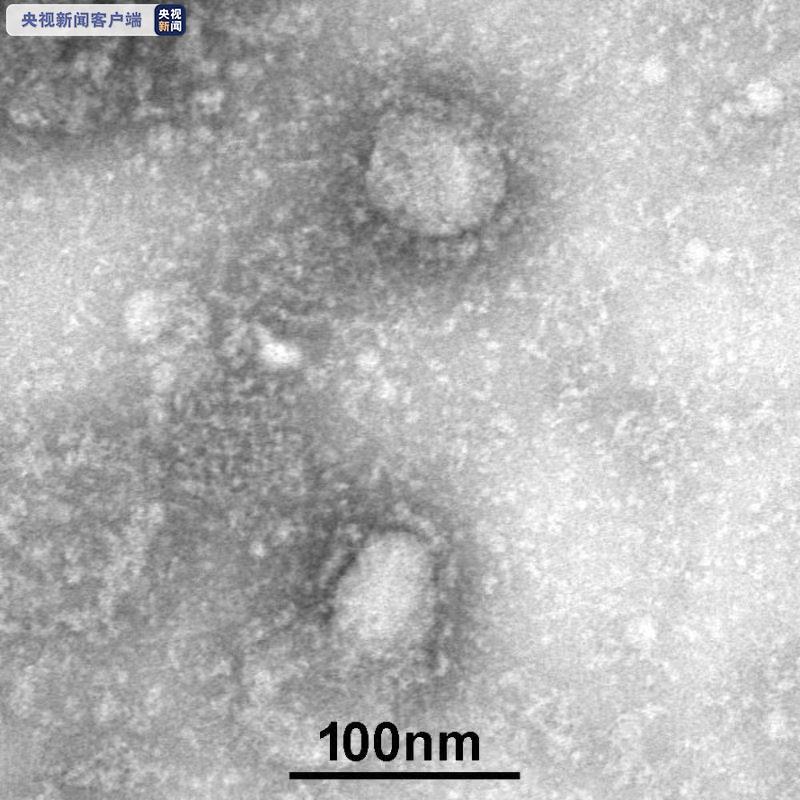 新型冠状病毒国家科技资源服务系统正式启动