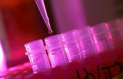 NIH宣布一项HIV疫苗临床试验失败