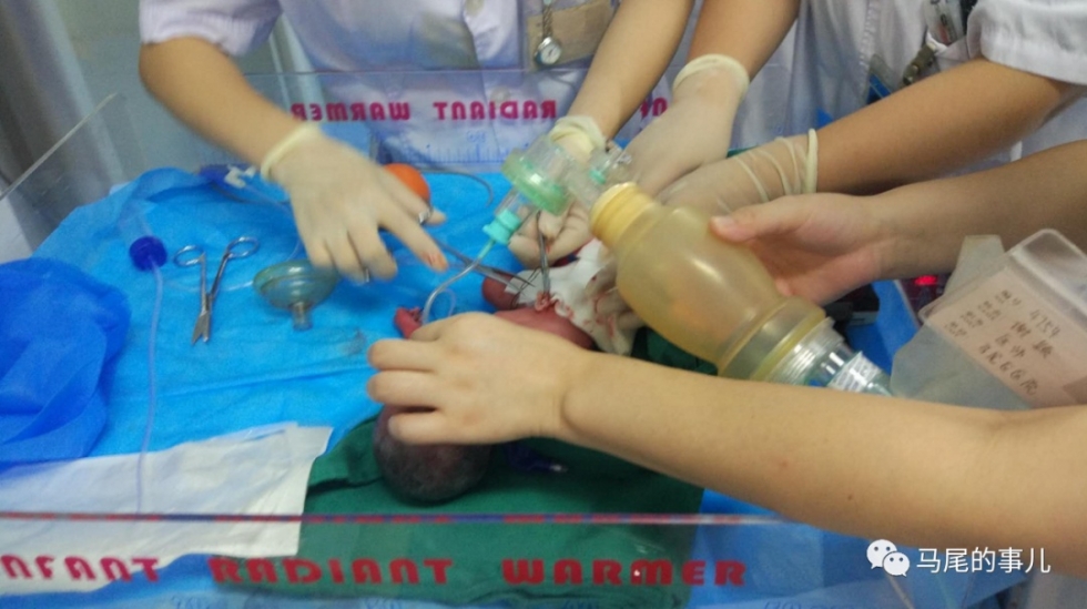 生命奇迹！这对27周早产儿被马尾区医院成功救治