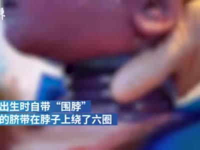 脐带绕颈6圈男婴顺产出生，母亲调侃孩子“会玩”